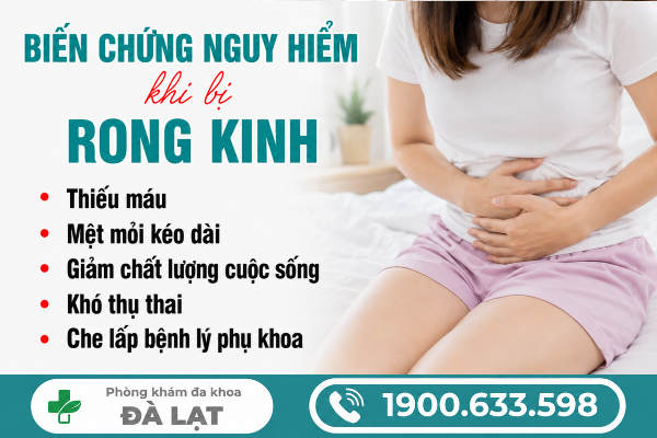 Hình ảnh minh họa